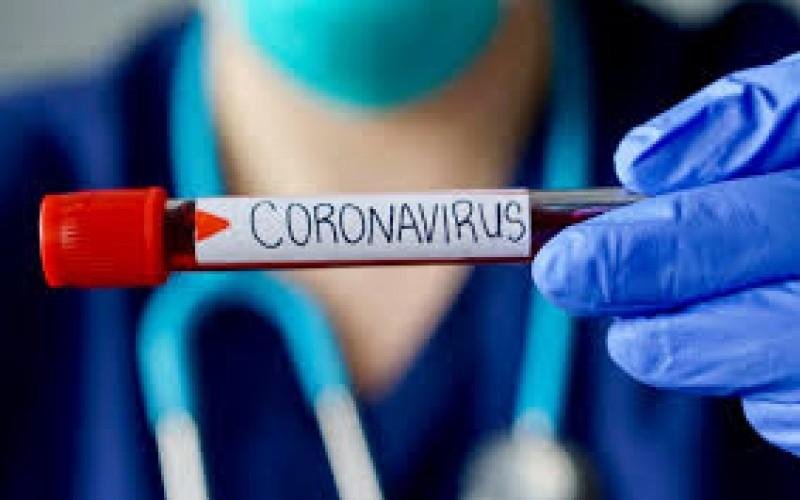 Koronavirusa yoluxanların gerçək sayı 20 dəfə çoxdur - ARAŞDIRMA
