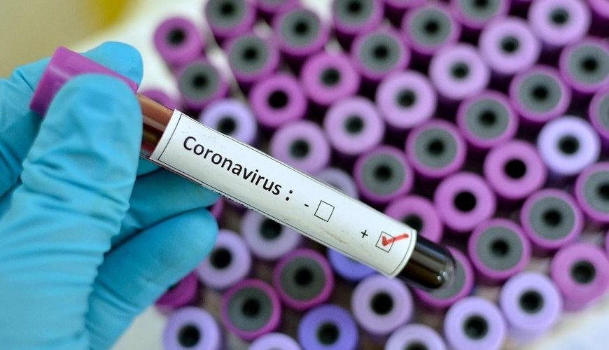 Son sutkada koronavirusa yoluxanların SAYI AÇIQLANDI