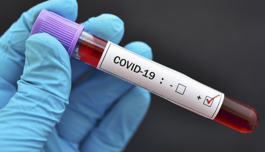 Rusiya COVID-19-a qarşı növbəti vaksini dövriyyəyə buraxıb